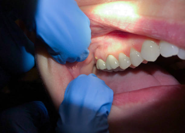 Best Pediatric Emergency Dentist in Gainesville, VA